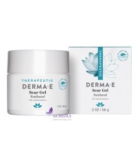 Derma E Therapeutic Гель от шрамов и рубцов, 56 г